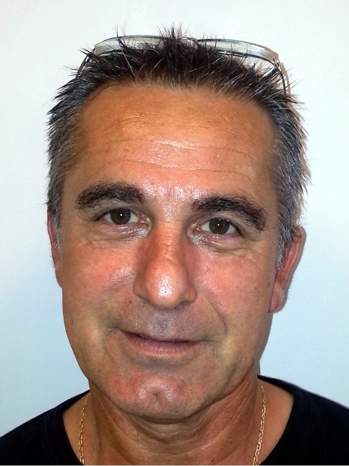 Esposito